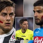 Alasan Tanda Merah di Wajah Pemain Juventus dan Para Bintang Serie A