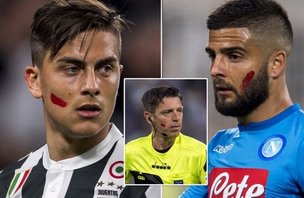Alasan Tanda Merah di Wajah Pemain Juventus dan Para Bintang Serie A